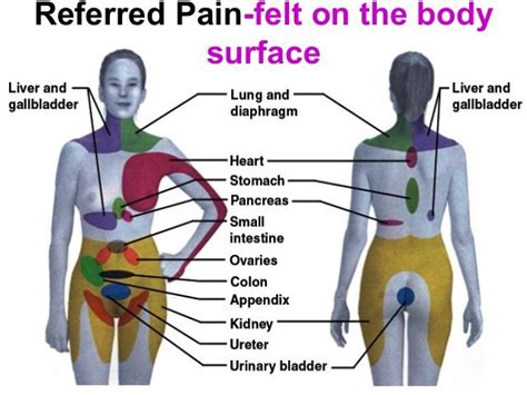 Referred Pain Chart Anatomy