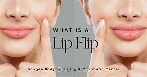 Lip Flip Botox Before And After Photos - Infoupdate.org