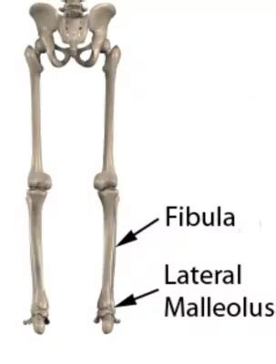 Lateral Malleolus Fracture - PhysioAdvisor