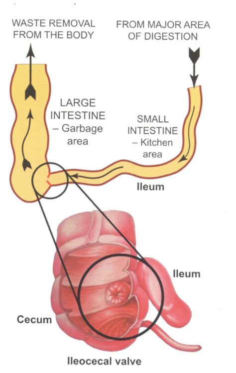 Open Ileocecal Valve - San Rafael Holistic, Natural & Preventive ...