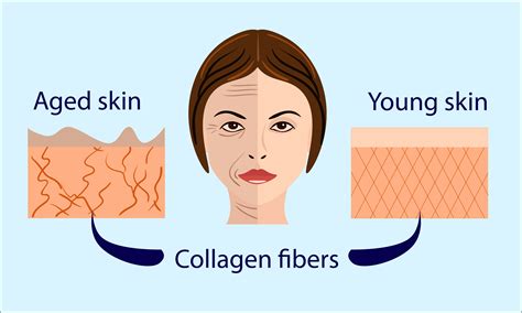 What is Collagen Remodeling? - Blog, Cosmetic Treatments