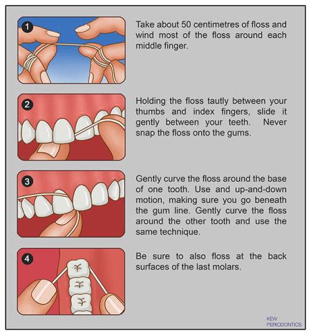 Correct Way To Floss Your Teeth - Teeth Poster