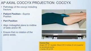 Sacrum And Coccyx X Ray