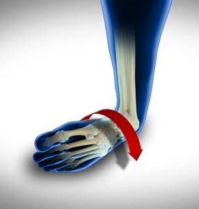 Ankle Instability Surgery Denver, CO | Ankle Sprains Denver, CO