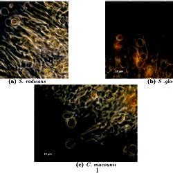 Microscope images of hymenium structures.