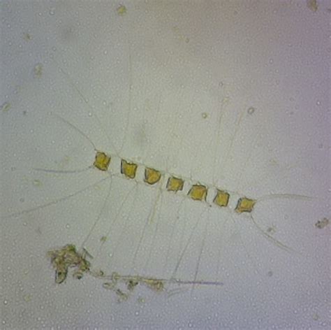 Chaetoceros (GTM Research Reserve Plankton Guide) · iNaturalist