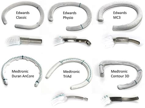 Tricuspid Annuloplasty Rings: A Quantitative Comparison of Size ...