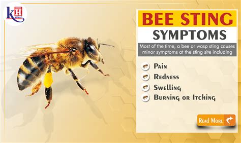 Bee Sting Allergy: Symptoms of Anaphylaxis