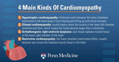 Cardiomyopathy – types, causes, treatment – Healthy Food Near Me