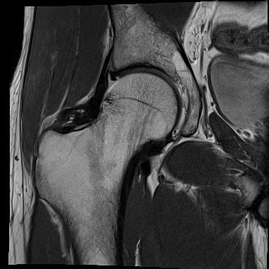 Diagnostics: Knee and Ankle X-rays — Taming the SRU