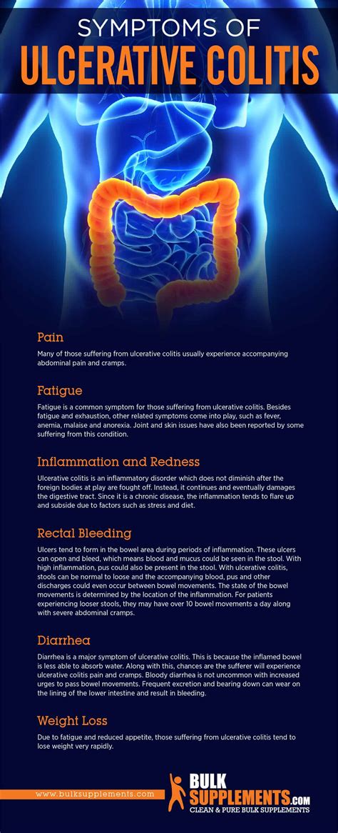 Ulcerative Colitis: Symptoms, Causes & Treatment by James Denlinger