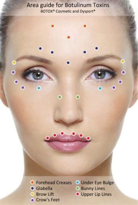 Botox Injection Face Chart