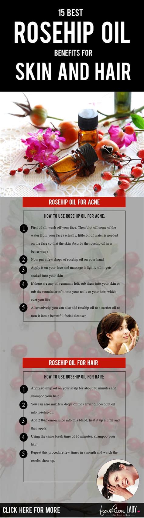 15 Best Rosehip Oil Benefits For Skin And Hair