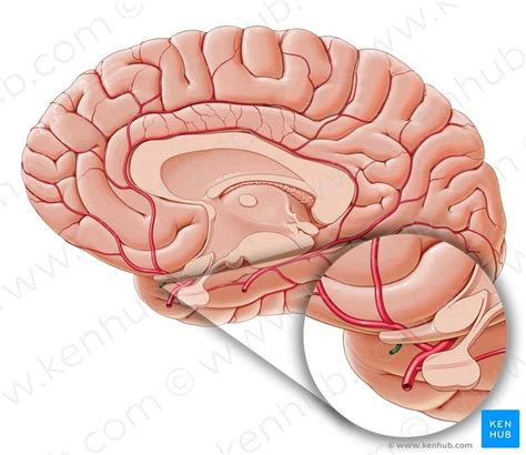 Pictures Of Anterior Communicating Artery