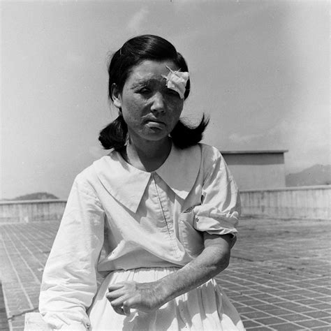 Hiroshima: Photos of Survivors of the World's First Atomic Attack