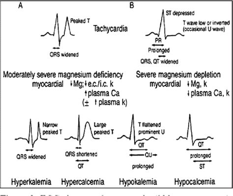 Figure 3 from Hypomagnesemia and cardiovascular system. | Semantic Scholar