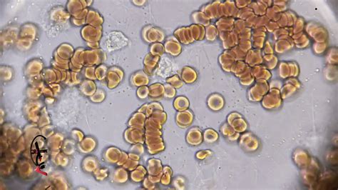 White Blood Cells Under Microscope Labeled