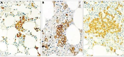 (A) Haematoxylin and eosin staining and (B) immunohistochemical ...