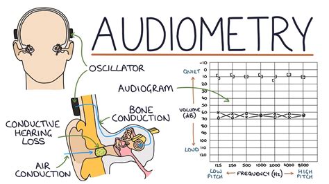 Conductive Hearing Loss Audiogram