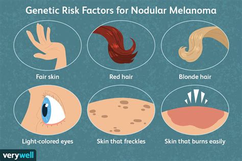 Melanoma - ZohebAmaryss