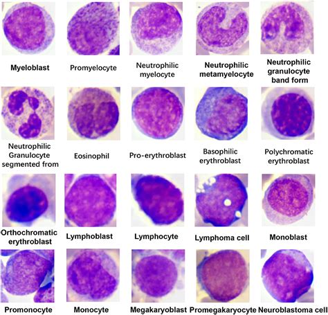 Frontiers | Development and Evaluation of a Leukemia Diagnosis System ...