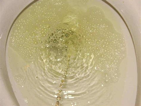 Bubbles in urine during pregnancy