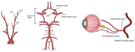 Ocular Ischemic Syndrome and Its Related Experimental Models