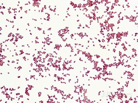 Gram Negative Rods And Gram Positive Cocci