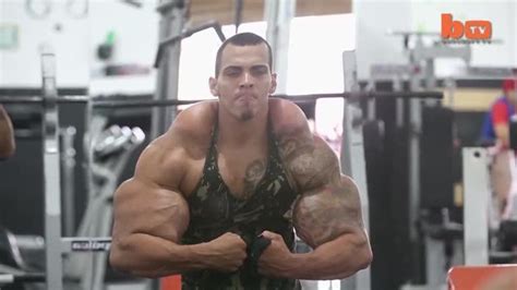 Russian bodybuilder’s bulking oil injections result in 24-inch biceps ...