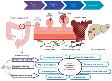 Schematic depiction of the adenoma-carcinoma-metastasis process. The ...