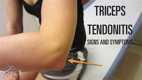 Triceps Tendonitis: Signs, Symptoms And Treatment Options | atelier ...