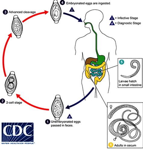 Trichuris trichiura infection, transmission, lifee cycle, symptoms ...