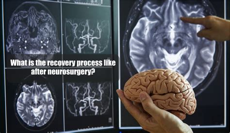 What is the Recovery Process Like After Neurosurgery? | Dr Baker ...