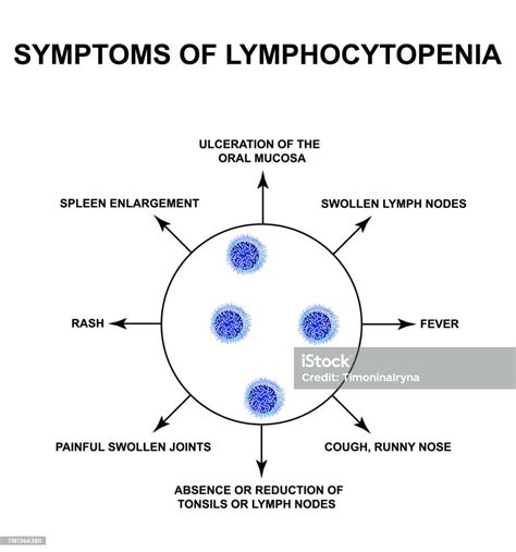 Symptoms Of Lymphocytopenia Decreased Lymphocytes In The Blood ...