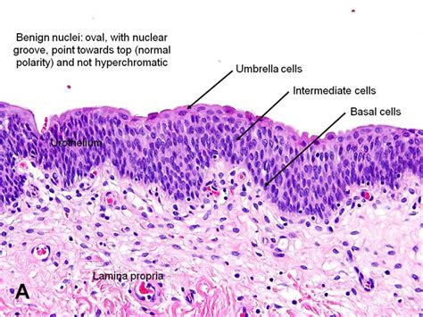 American Urological Association - Urinary Bladder: Normal Urothelium