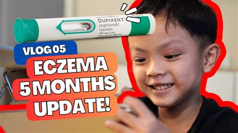 Vlog 05 | Dupixent for Eczema: Did it Work?! (5 Months Update!) - YouTube