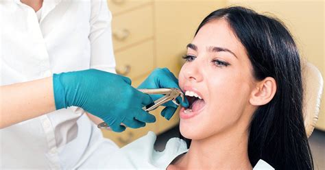 Tooth Extraction: The Top Signs a Tooth Extraction is Needed