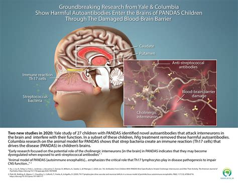 New research advances our understanding of PANS and PANDAS. - SUZANNE ...