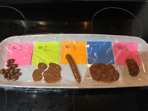 How Much Stool Is Needed For C Diff Test - HOW MUCH FER