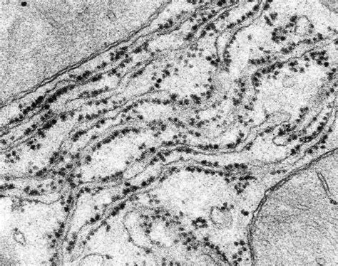 Ribosomes Electron Micrograph