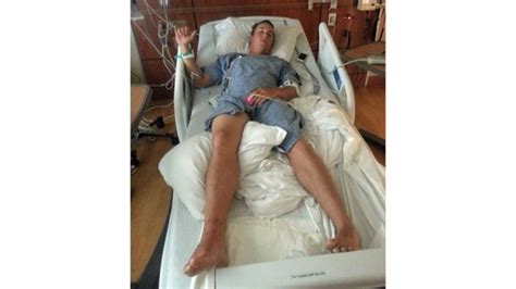 Man recovering after water moccasin bite