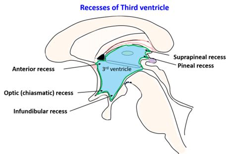 Third Ventricle , Location, boundaries, recesses and choroid plexus ...