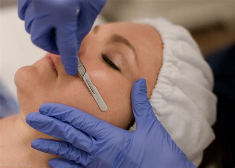 Dermaplaning Dermal Edge Therapy Epidermal Leveling Blading