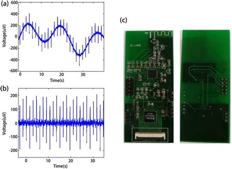 What is electrical signal