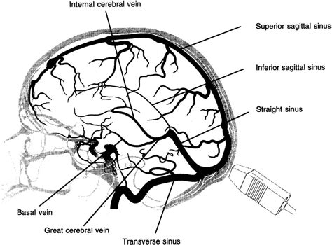 Great cerebral vein