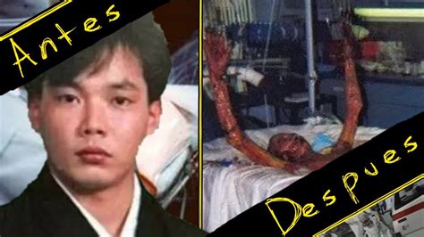 Hisashi Ouchi Death Picture: The Tragic Story Behind The Incident