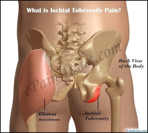 ボード「Sports Injuries」のピン