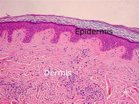 Dermis layers - Structure of dermis | the dynamic natural skin care