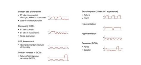 ETCO2 waveform interpretation Flashcards | Quizlet