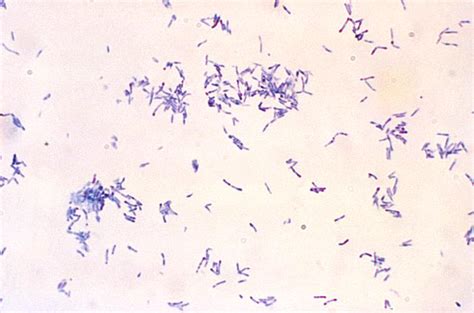 Corynebacterium Gram Stain